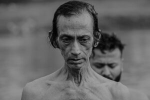 Photo piriformis syndrome